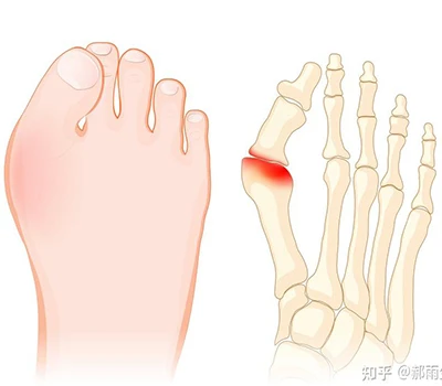 ہالکس ویلگس: ایک مکمل سائنس گائیڈ
