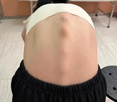 ریڑھ کی ہڈی کی صحت میں انقلاب: ژیانکو 3D باڈی اسکینر