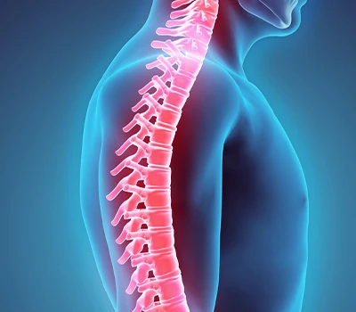 ریڑھ کی ہڈی کی اصلاح: تابکاری - مفت ڈیجیٹل ریڑھ کی ہڈی کا حل